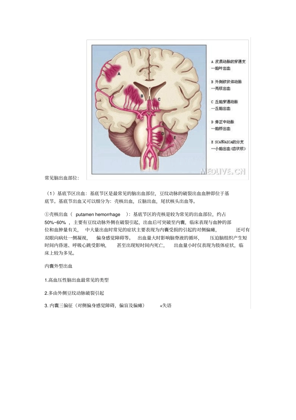 脑出血部位辨识汇总_第3页