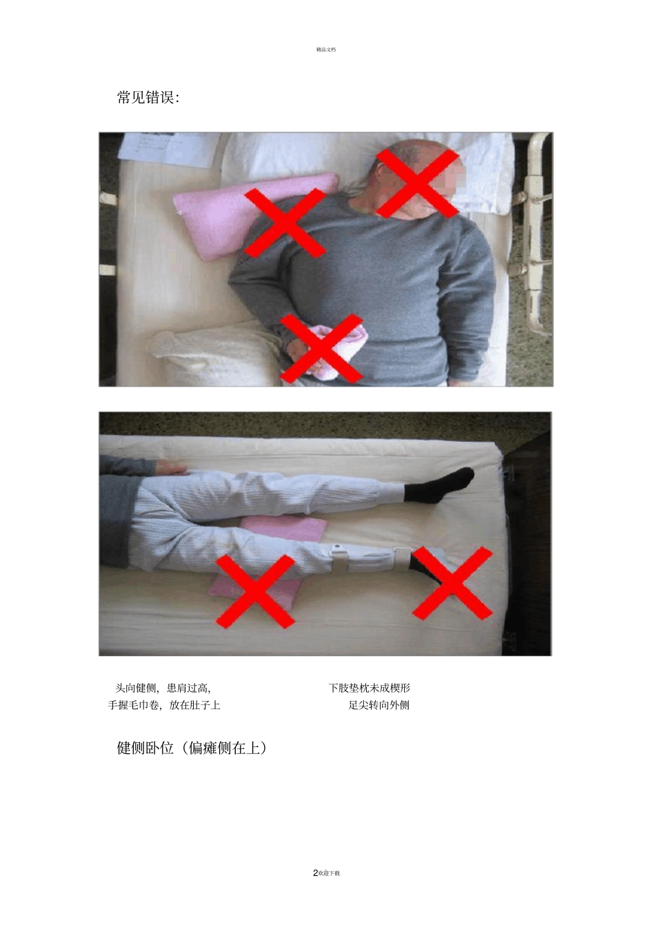 脑卒中患者的良肢位摆放_第2页