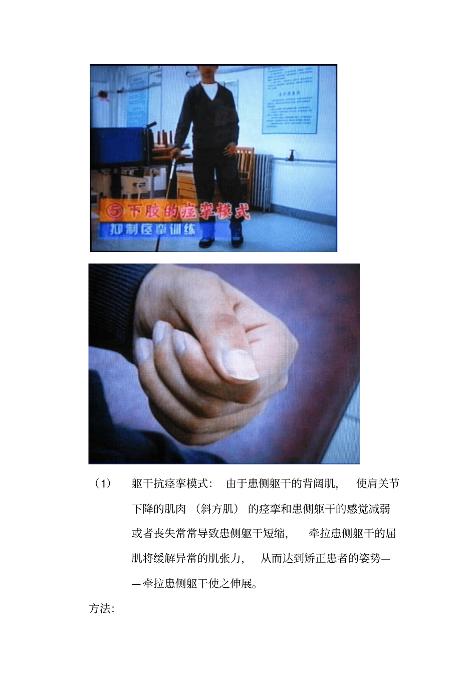 脑卒中的康复锻炼_第2页