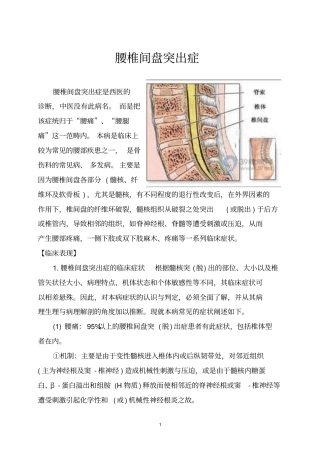 腰椎间盘突出症汇总