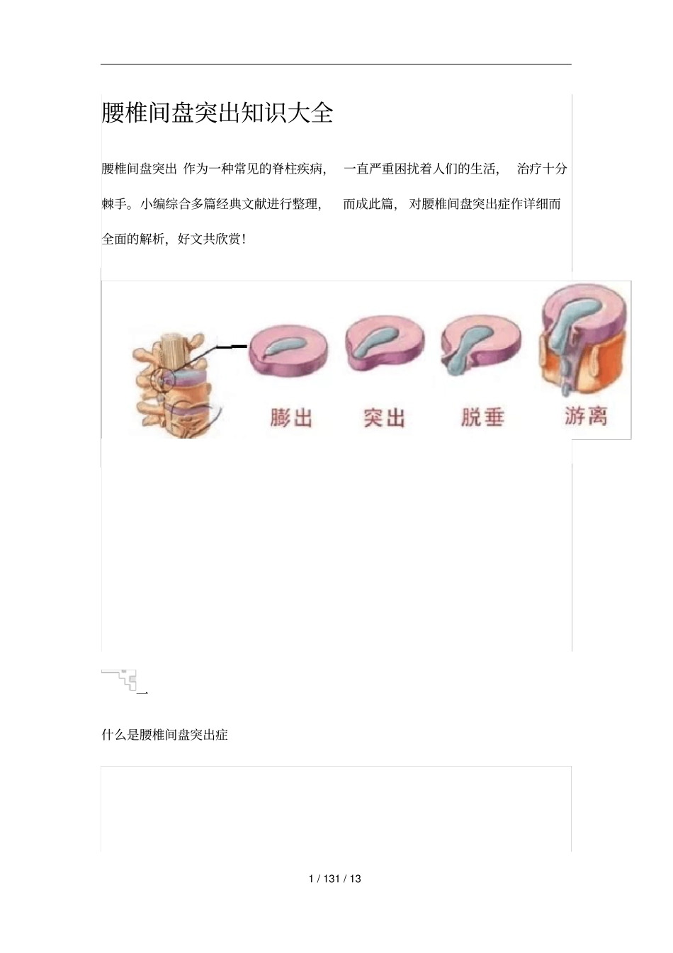 腰椎间盘突出知识大全_第1页