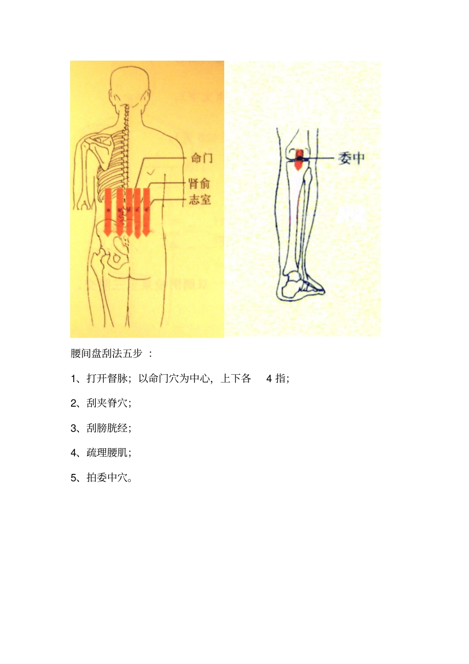 腰间盘刮法五步_第1页