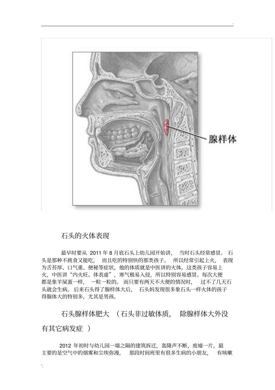 腺样体治疗治愈的亲身体会_第2页