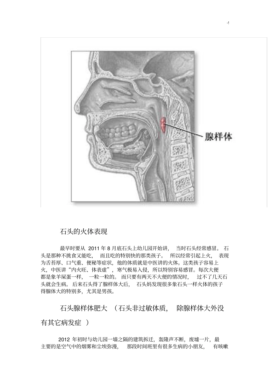 腺样体治疗治愈的亲身感想及体会_第2页