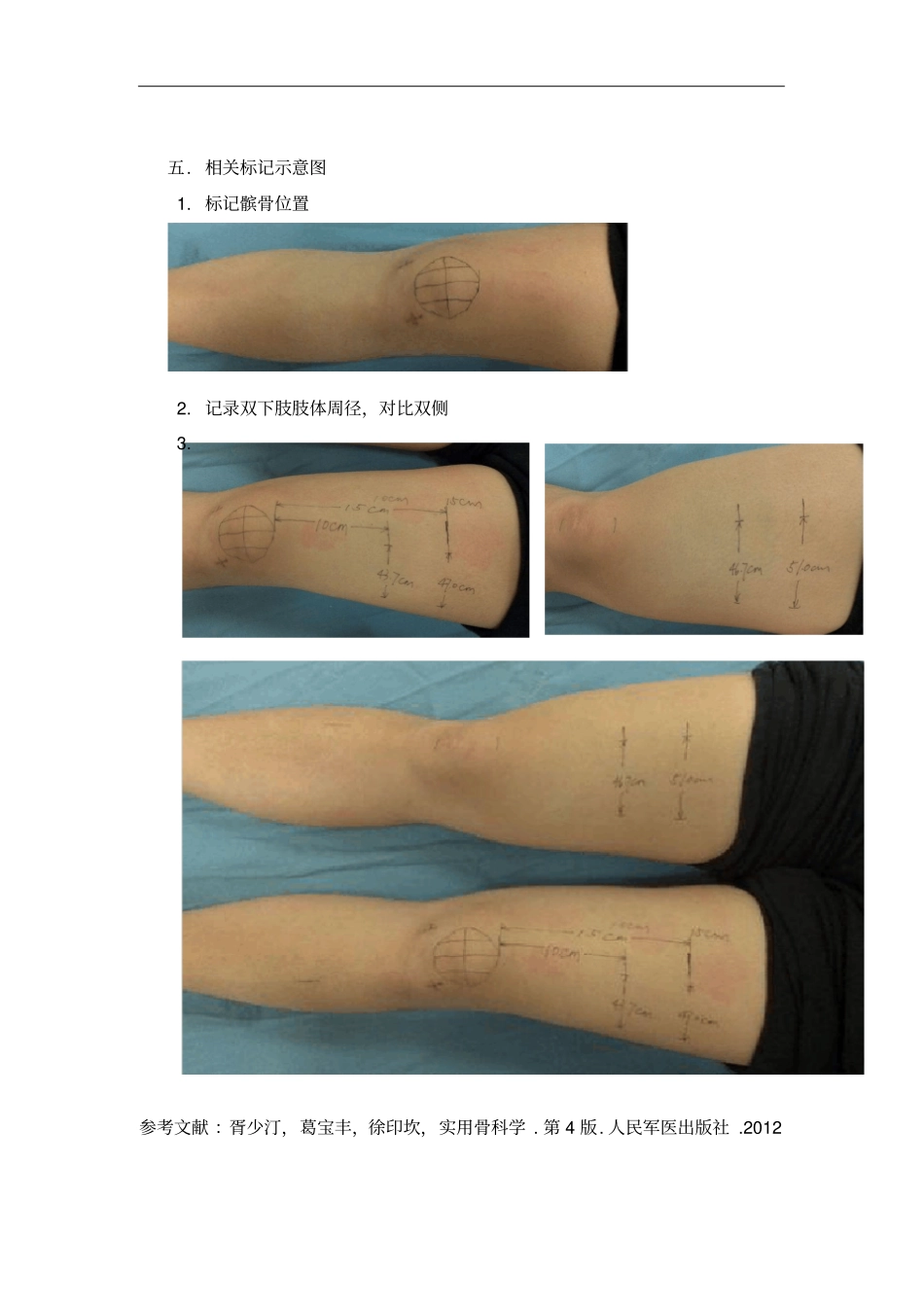 腿围测量规范_第2页