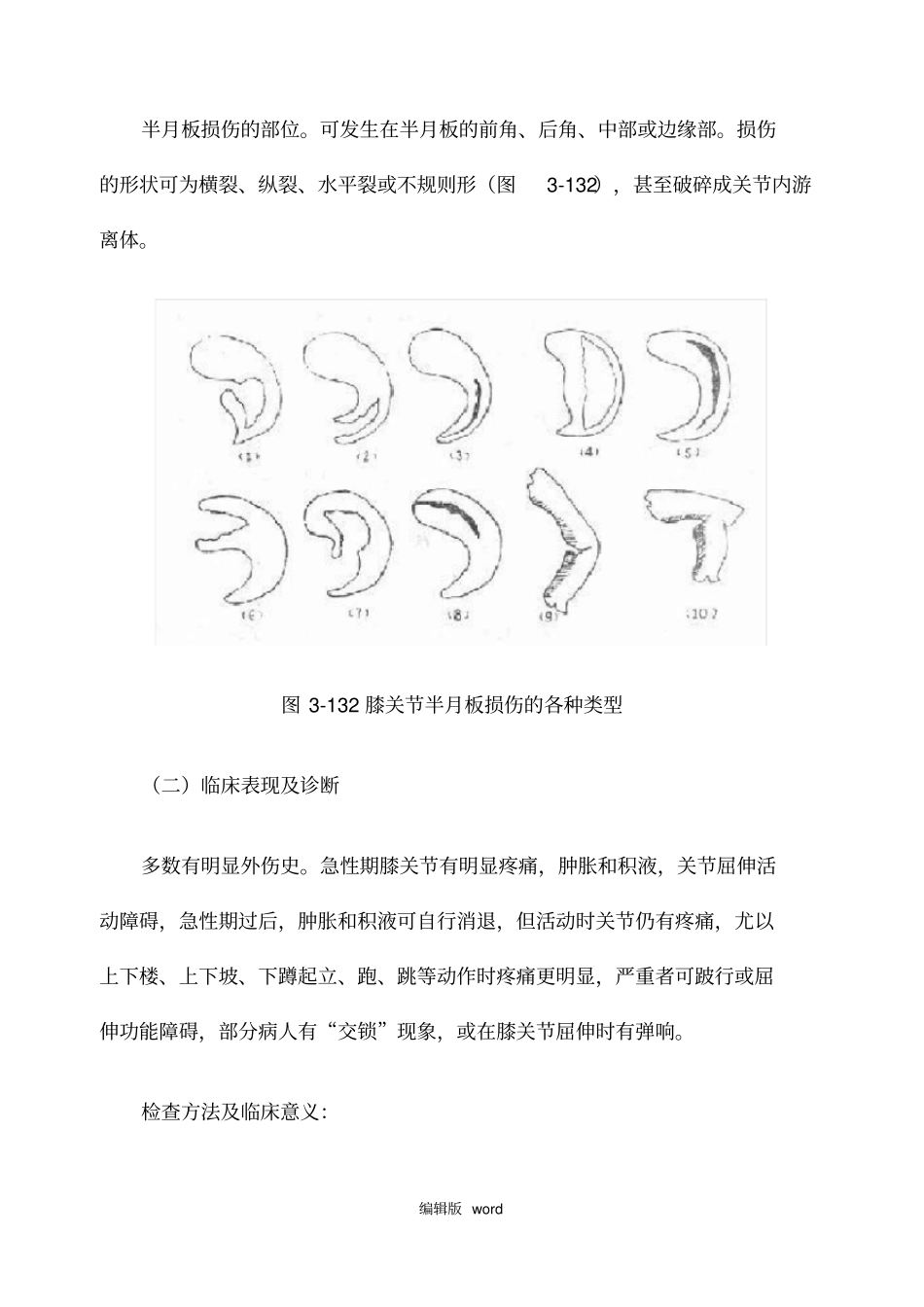 膝关节常见损伤_第3页