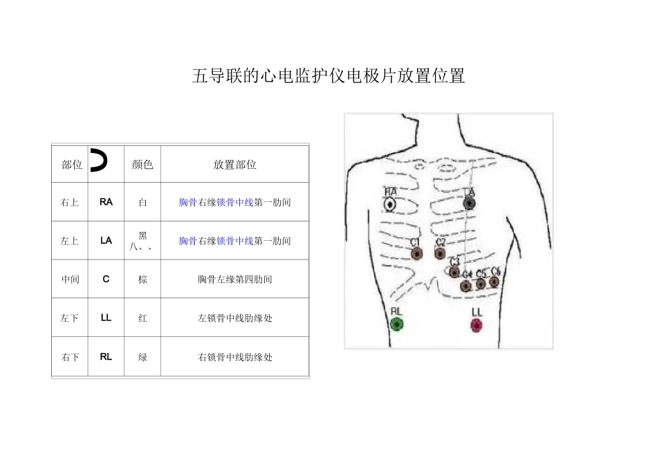 五导联的心电监护仪电极片放置位置剖析_第1页