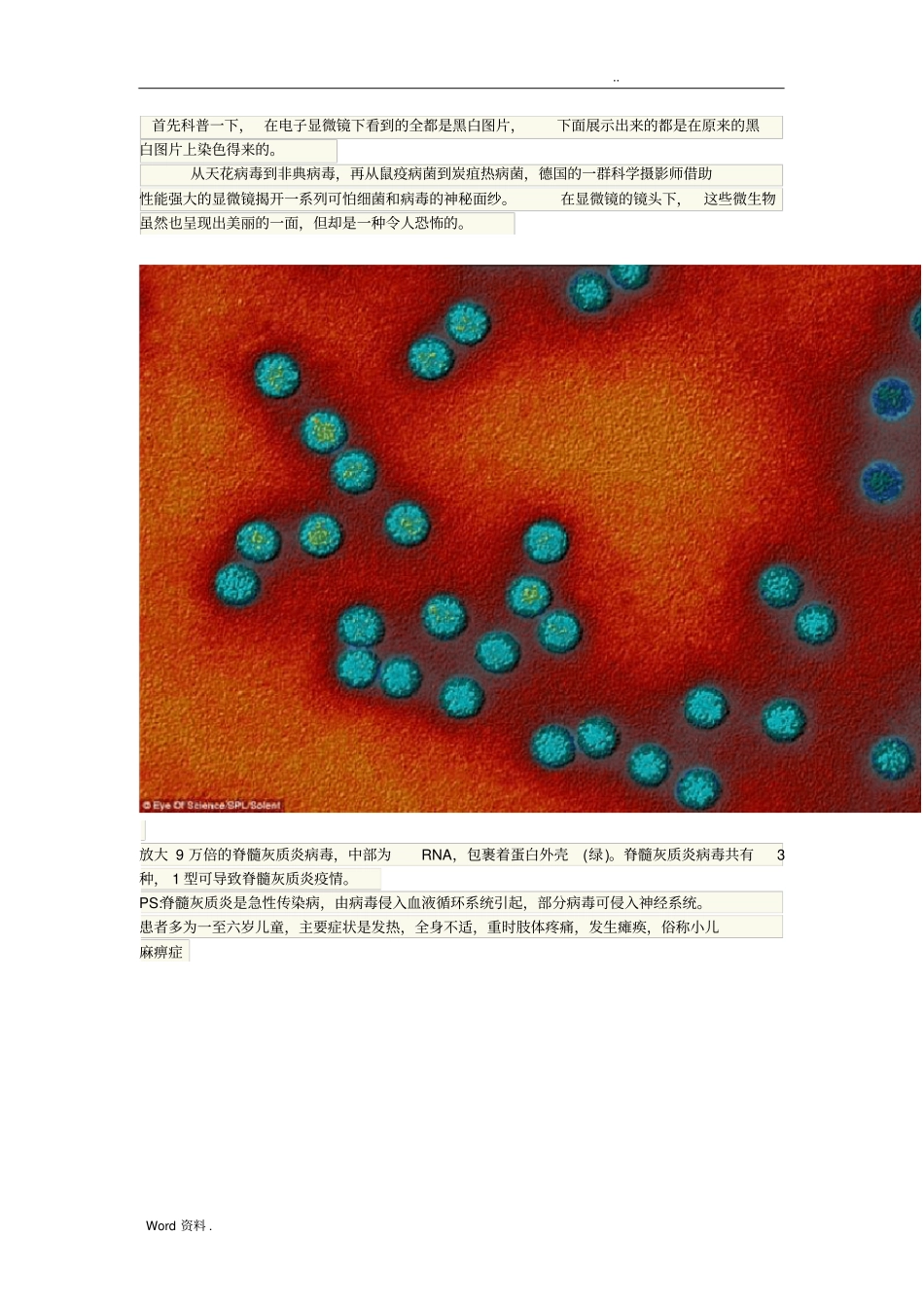 致命的美丽：显微镜下的细菌和病毒14P_第1页