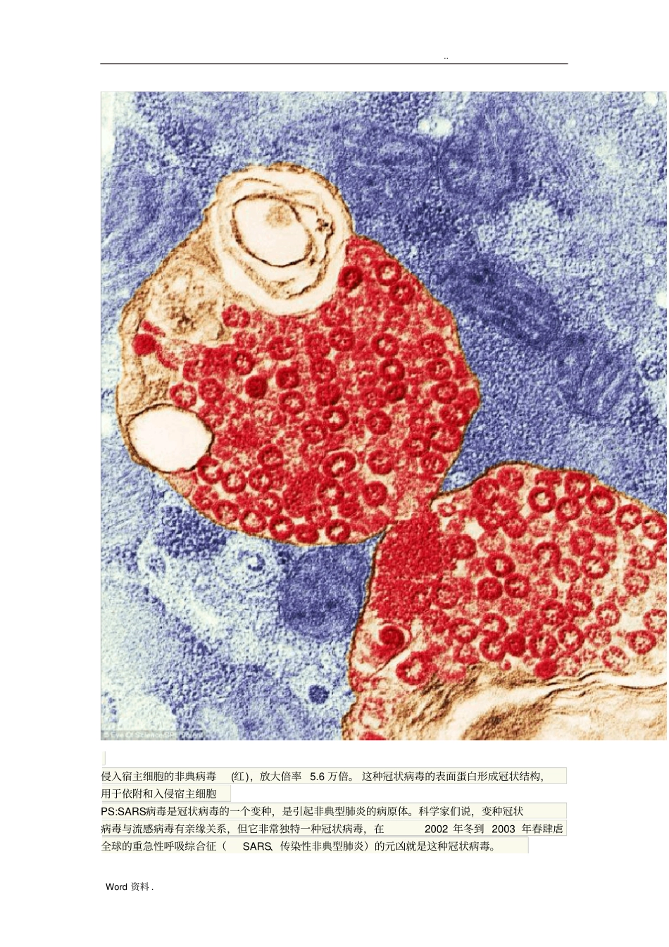 致命的美丽：显微镜下的细菌和病毒14P_第3页