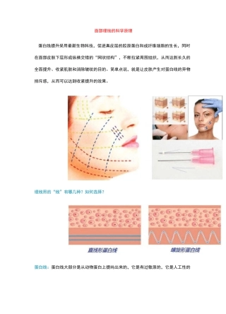 面部埋线的“线”有几种选择