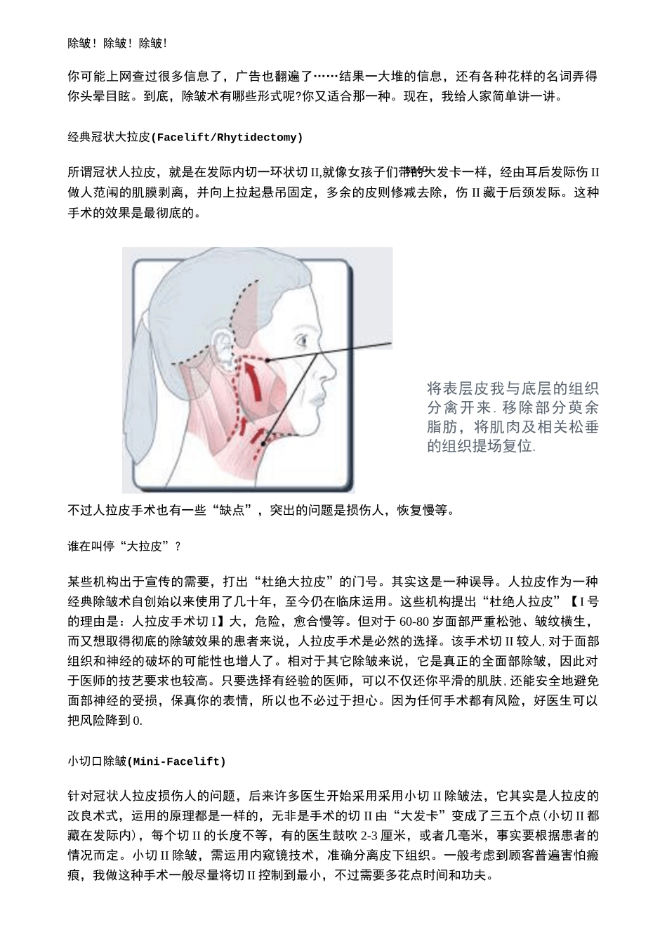 除皱手术大全_第2页