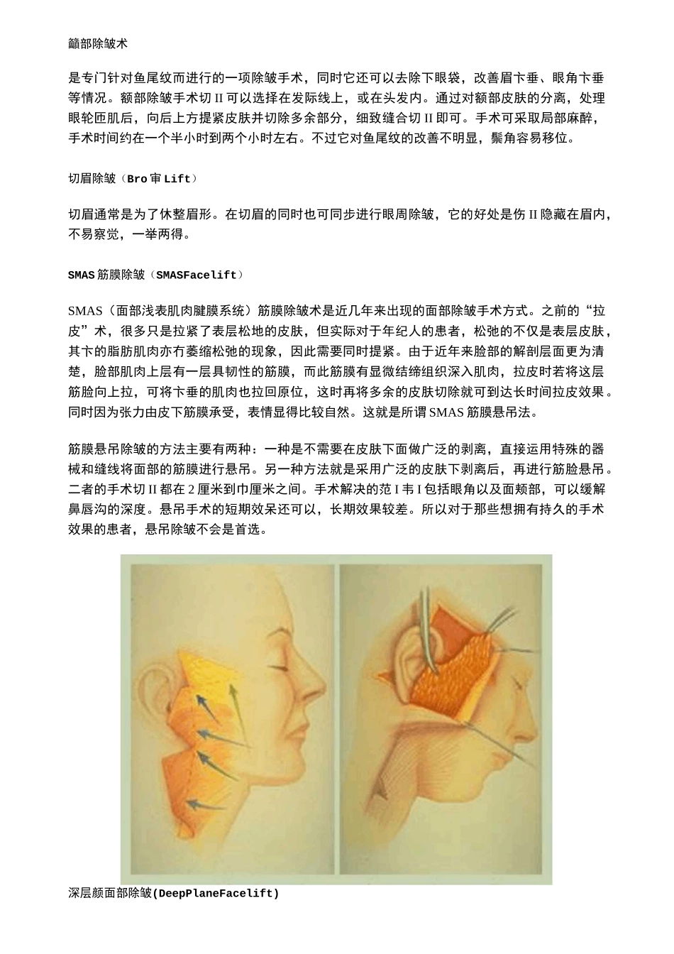 除皱手术大全_第3页