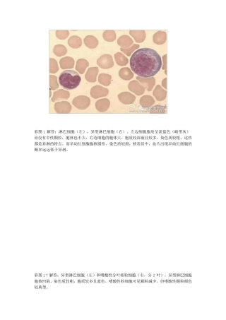 异型淋巴细胞的鉴定与区别
