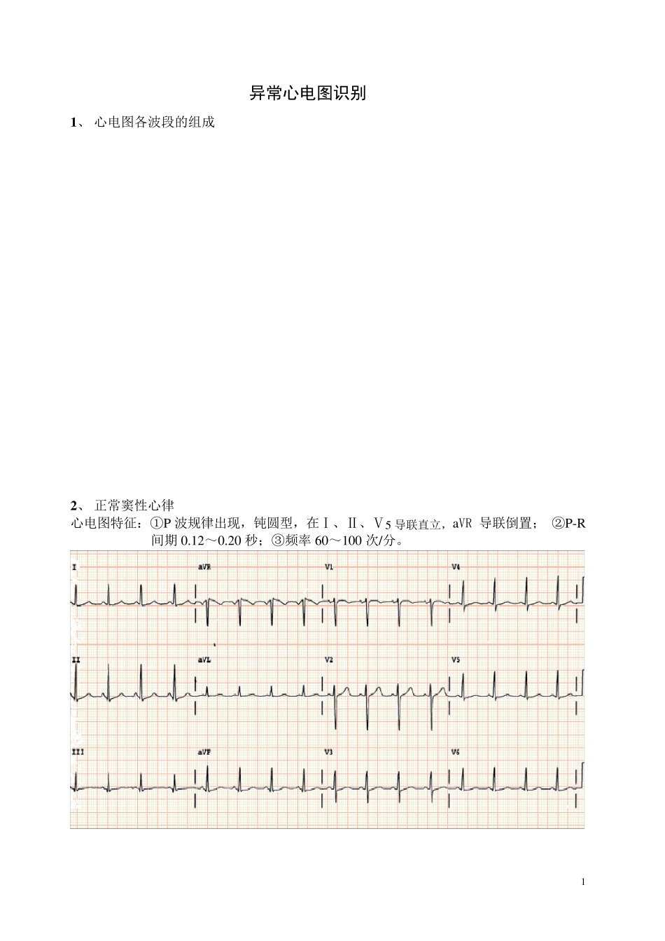 异常心电图识别__第1页