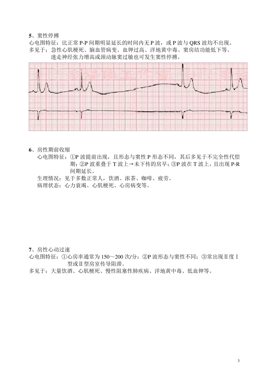 异常心电图识别__第3页