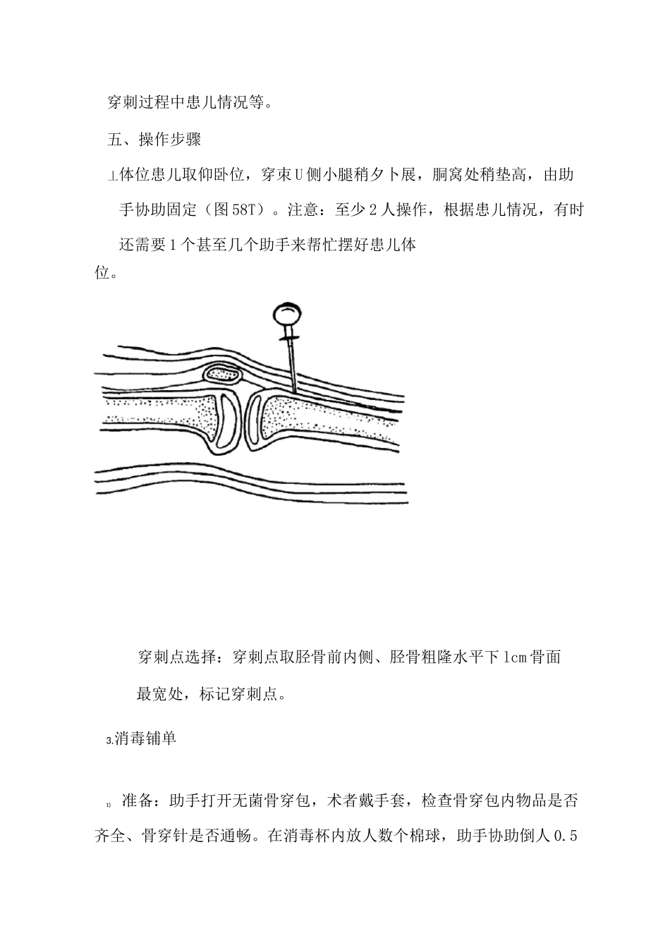 胫骨穿刺(骨髓)详细步骤及注意要点_第3页