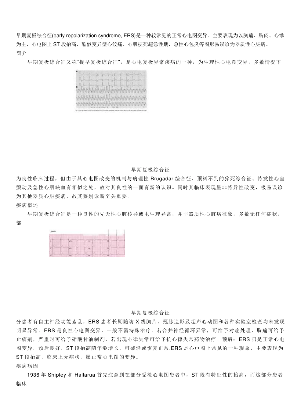 早期复极综合症_第1页
