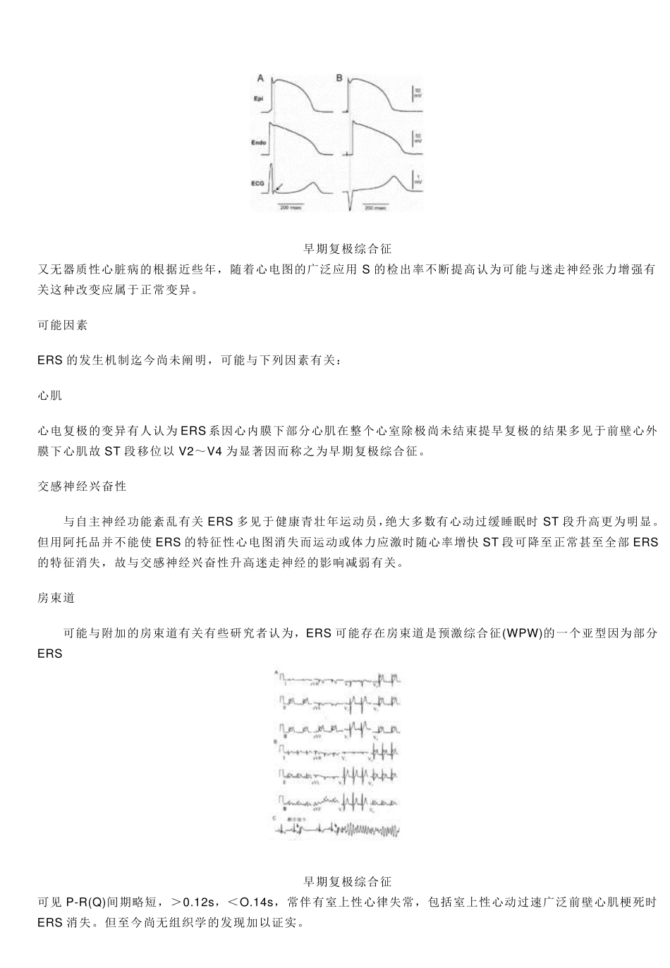 早期复极综合症_第2页