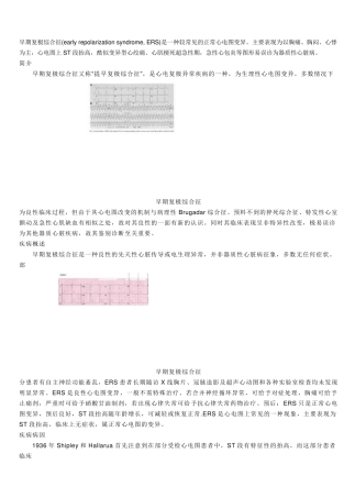早期复极综合症