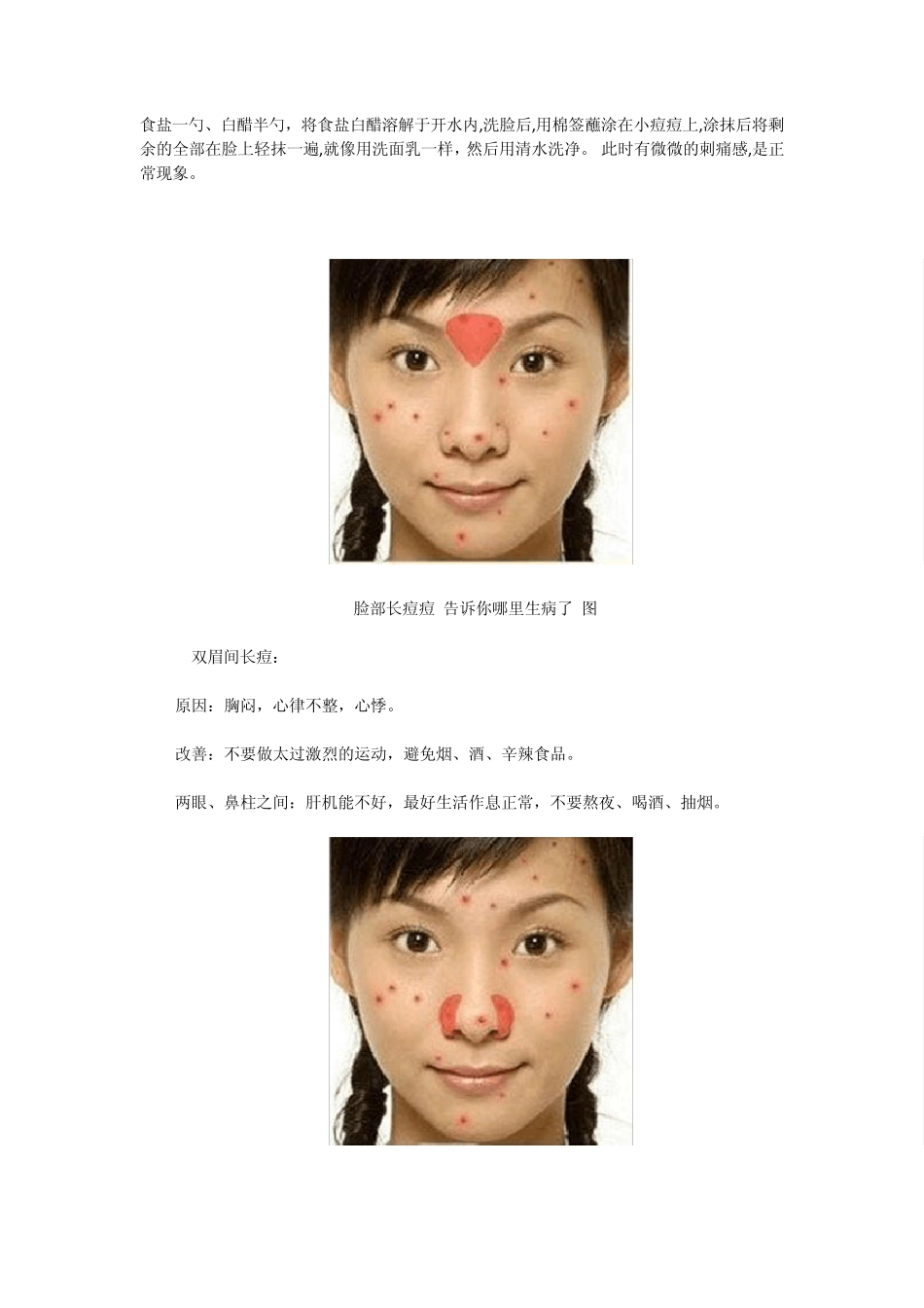 最全最好的脸上豆豆位置与身体五脏的关系及改善方法_第2页