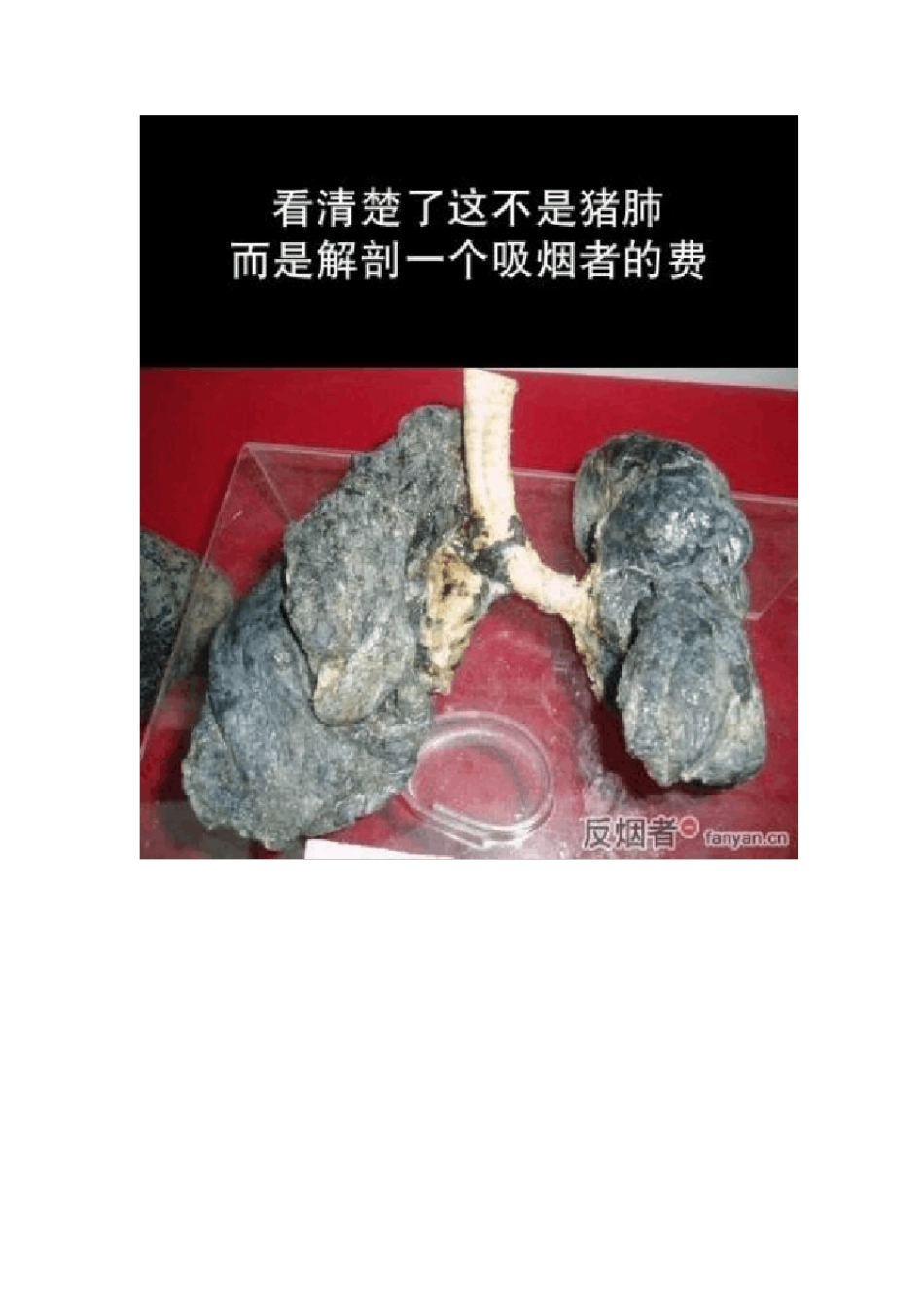 最全的吸烟危害大全(图文)_第3页