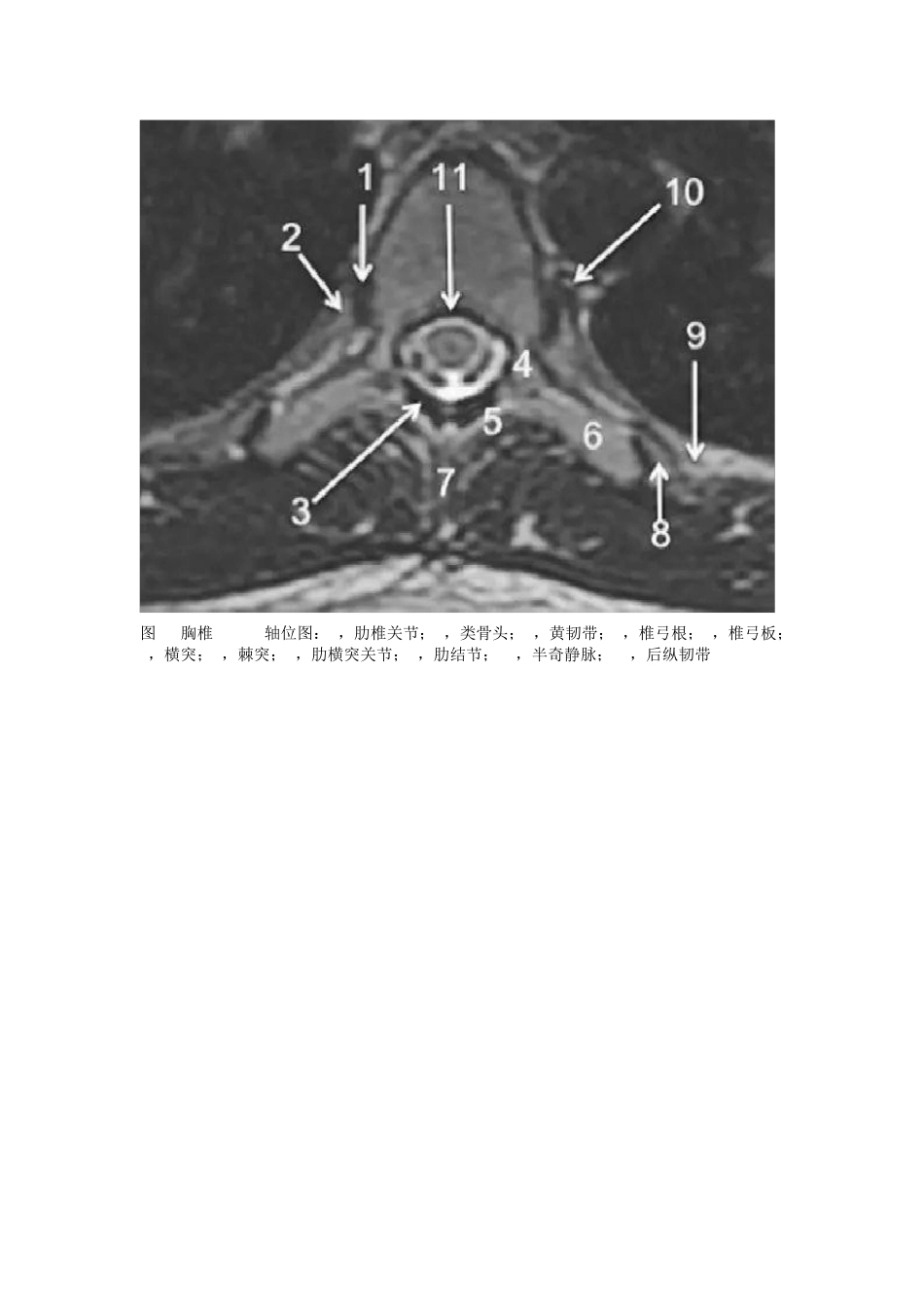 最全面的胸、腰椎MRI解剖_第2页