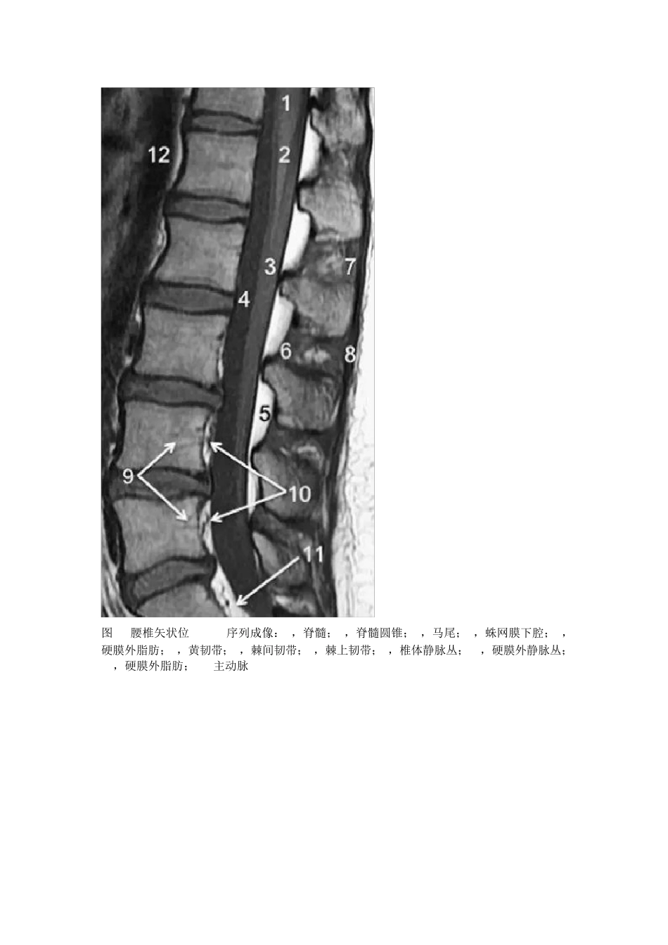 最全面的胸、腰椎MRI解剖_第3页