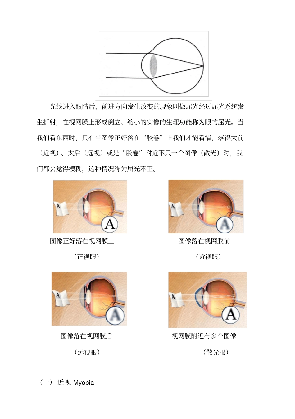 视光知识含近视知识_第2页