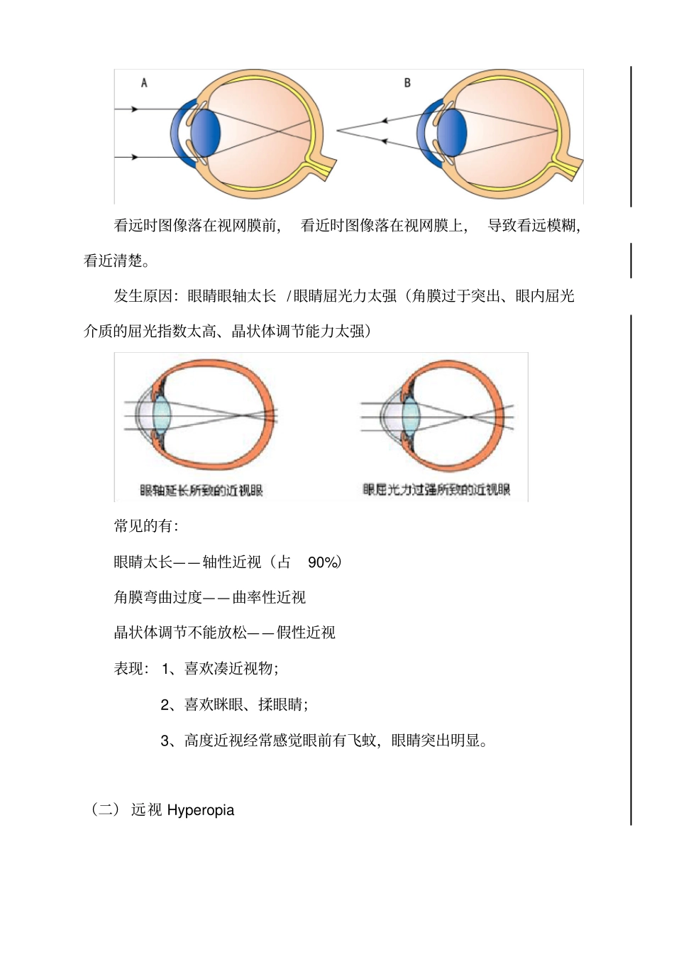 视光知识含近视知识_第3页