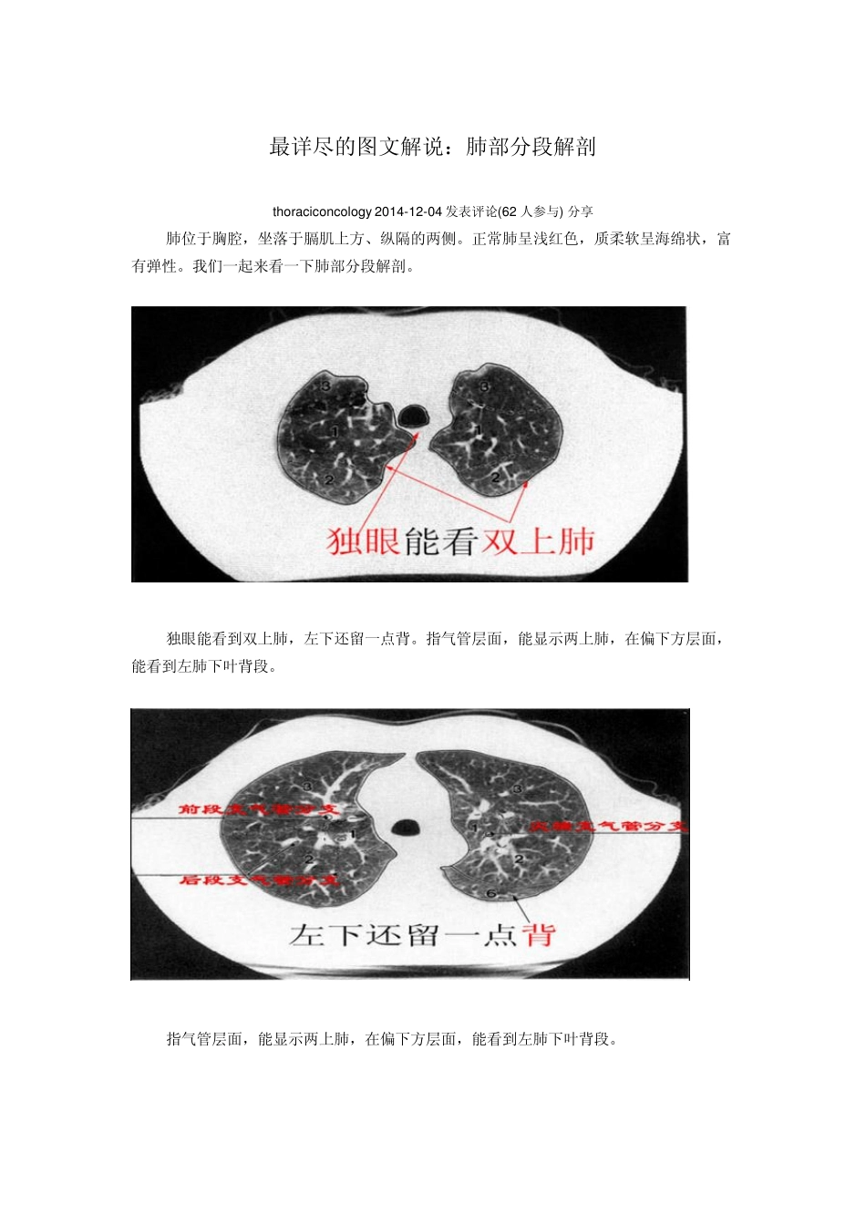 最详尽的图文解说：肺部分段解剖_第1页