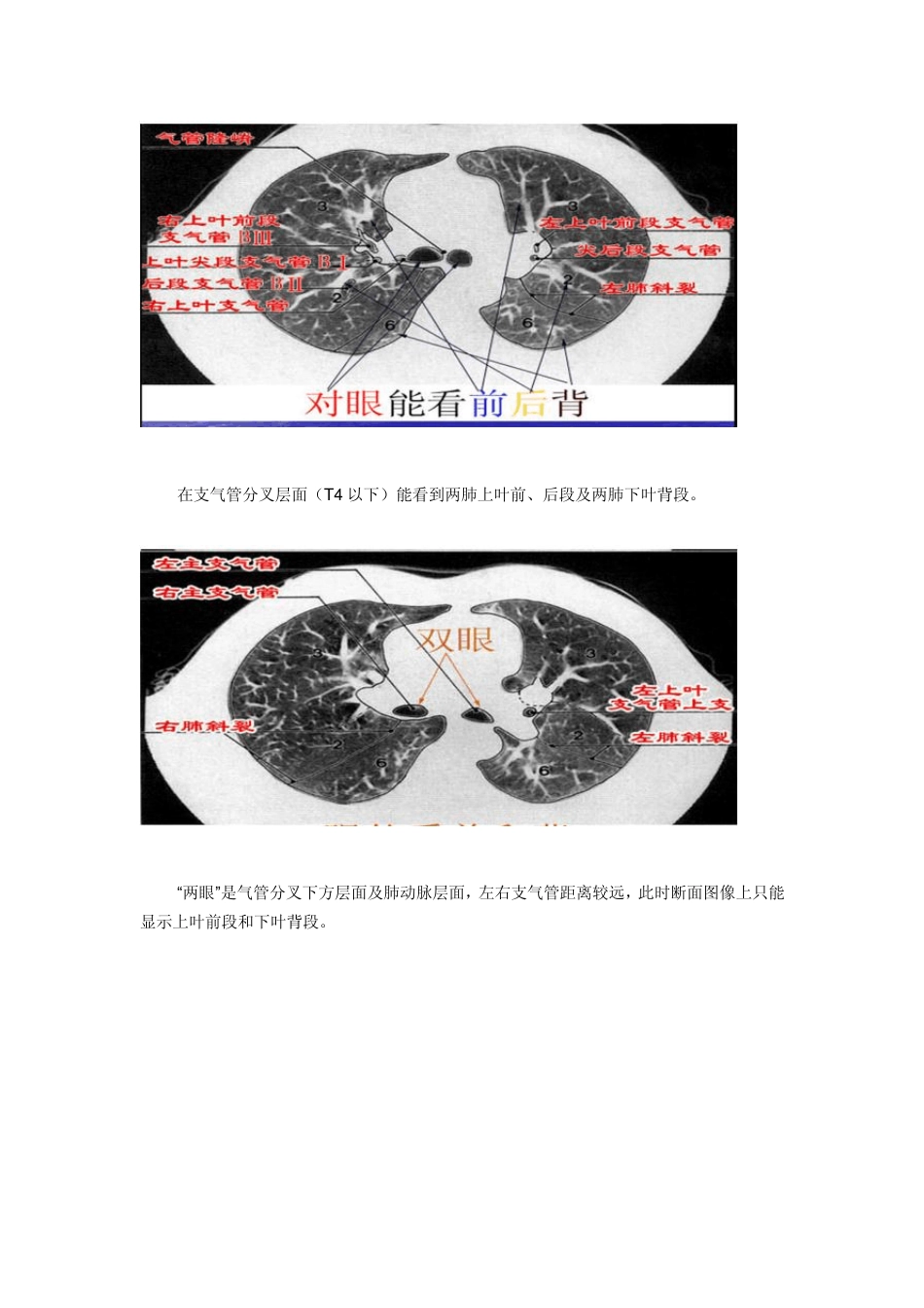 最详尽的图文解说：肺部分段解剖_第2页