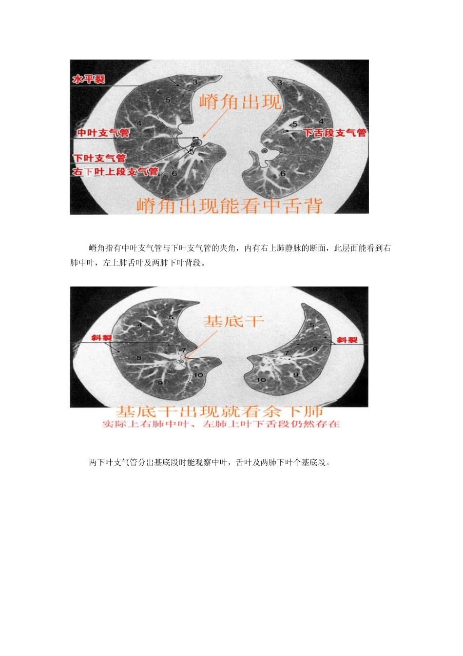 最详尽的图文解说：肺部分段解剖_第3页
