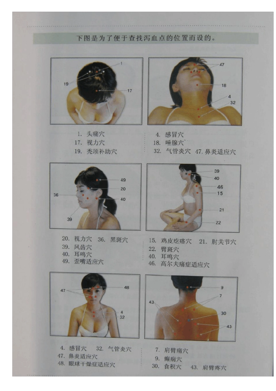 泻血疗法51穴位图讲解_第3页