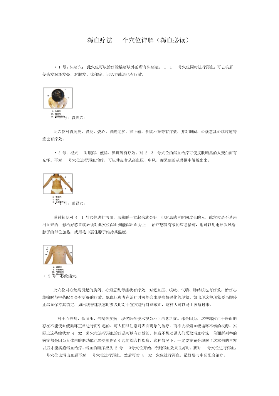 泻血疗法60个穴位详解_第1页
