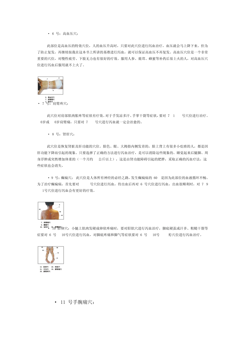 泻血疗法60个穴位详解_第2页