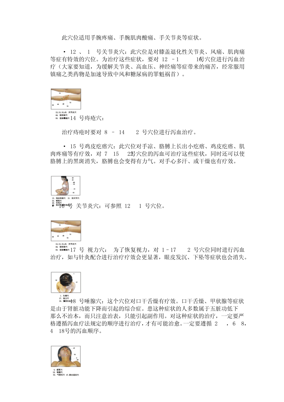 泻血疗法60个穴位详解_第3页