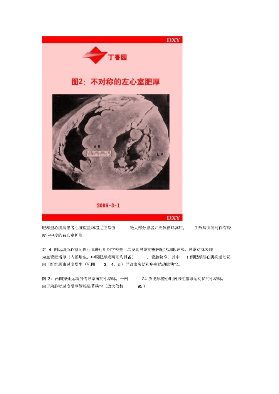 运动员与猝死_第2页