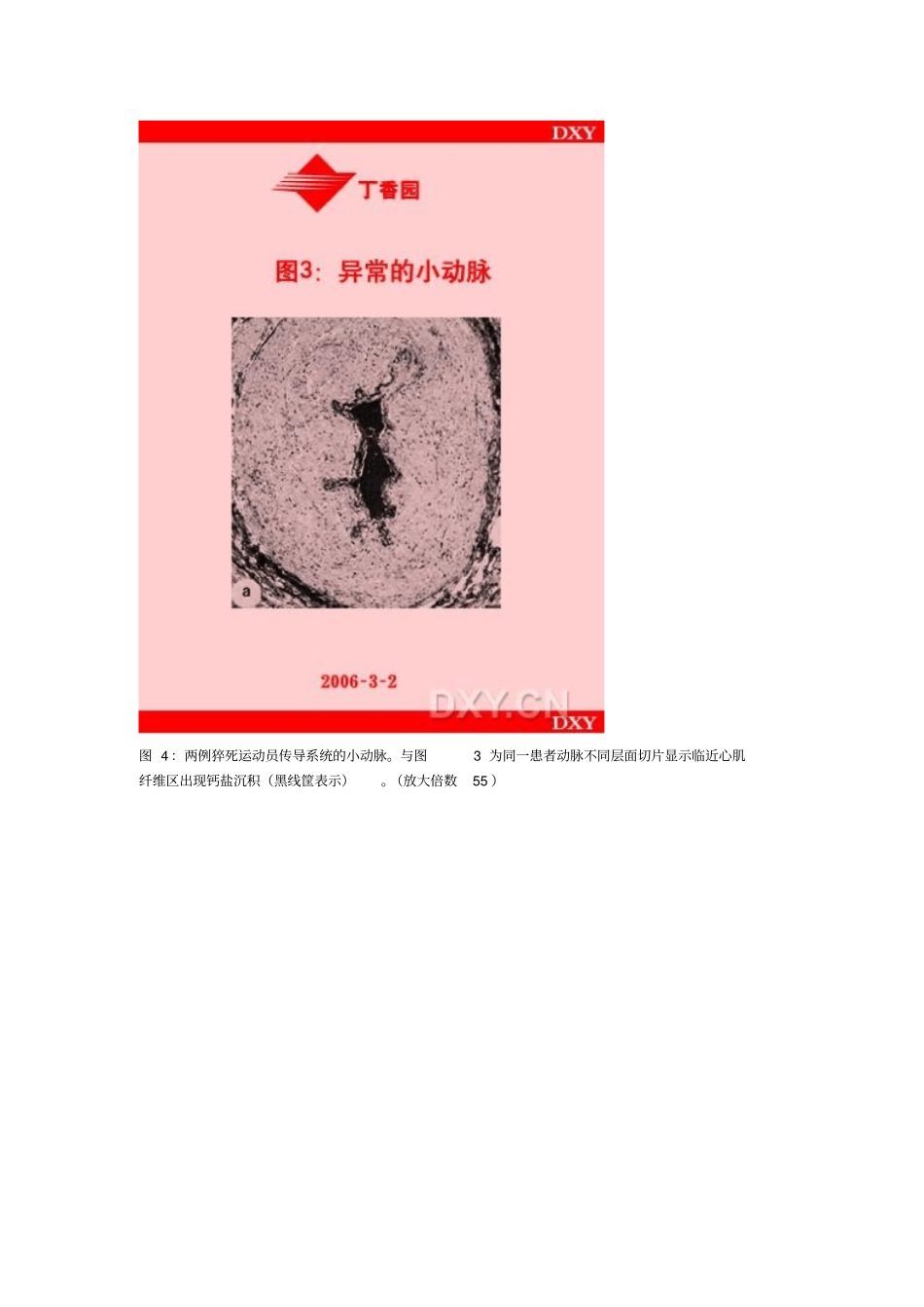 运动员与猝死_第3页