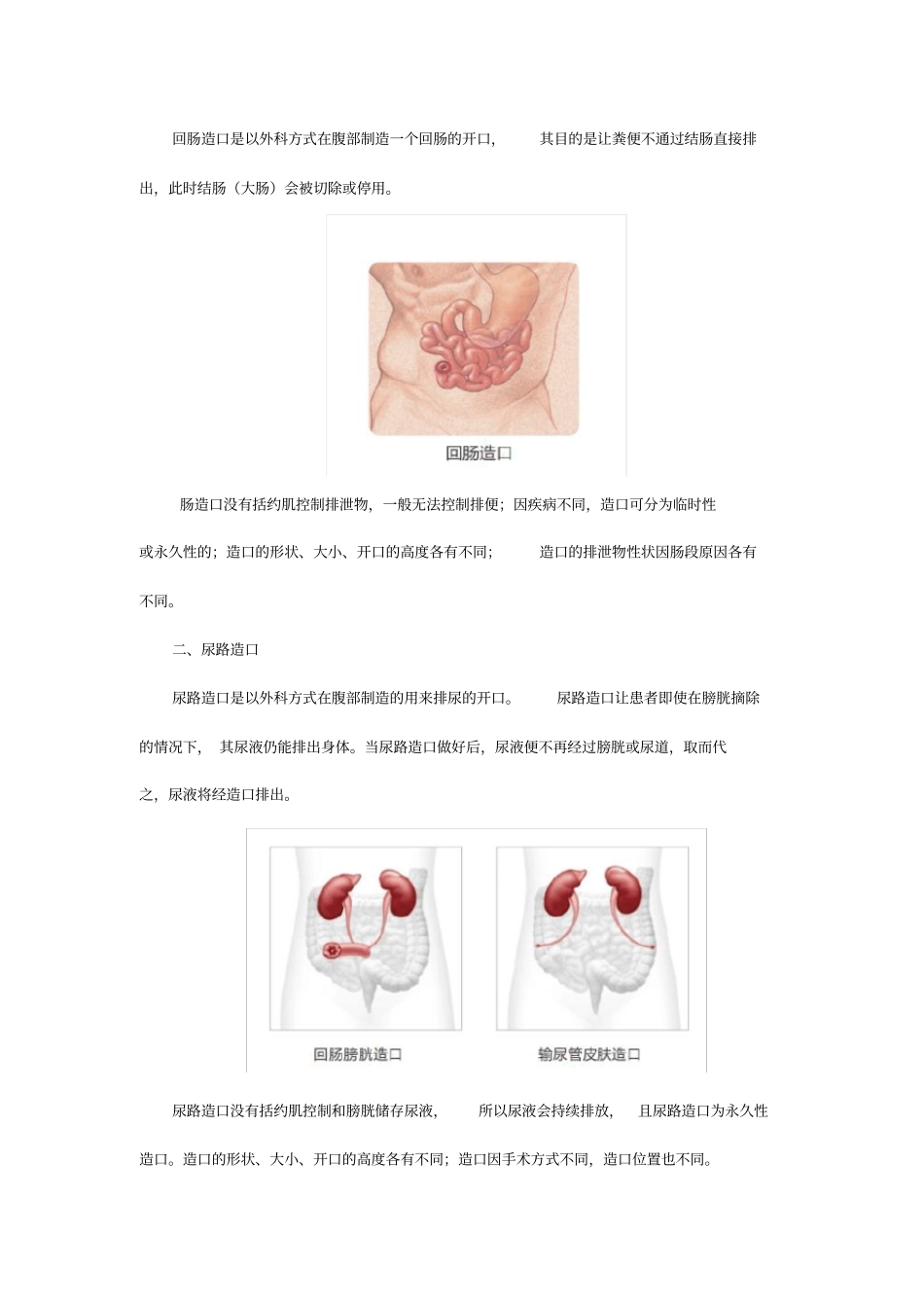 选好造口用品,从了解你的造口开始_第2页