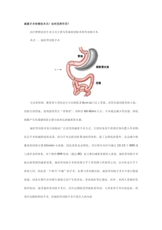 减重手术概述