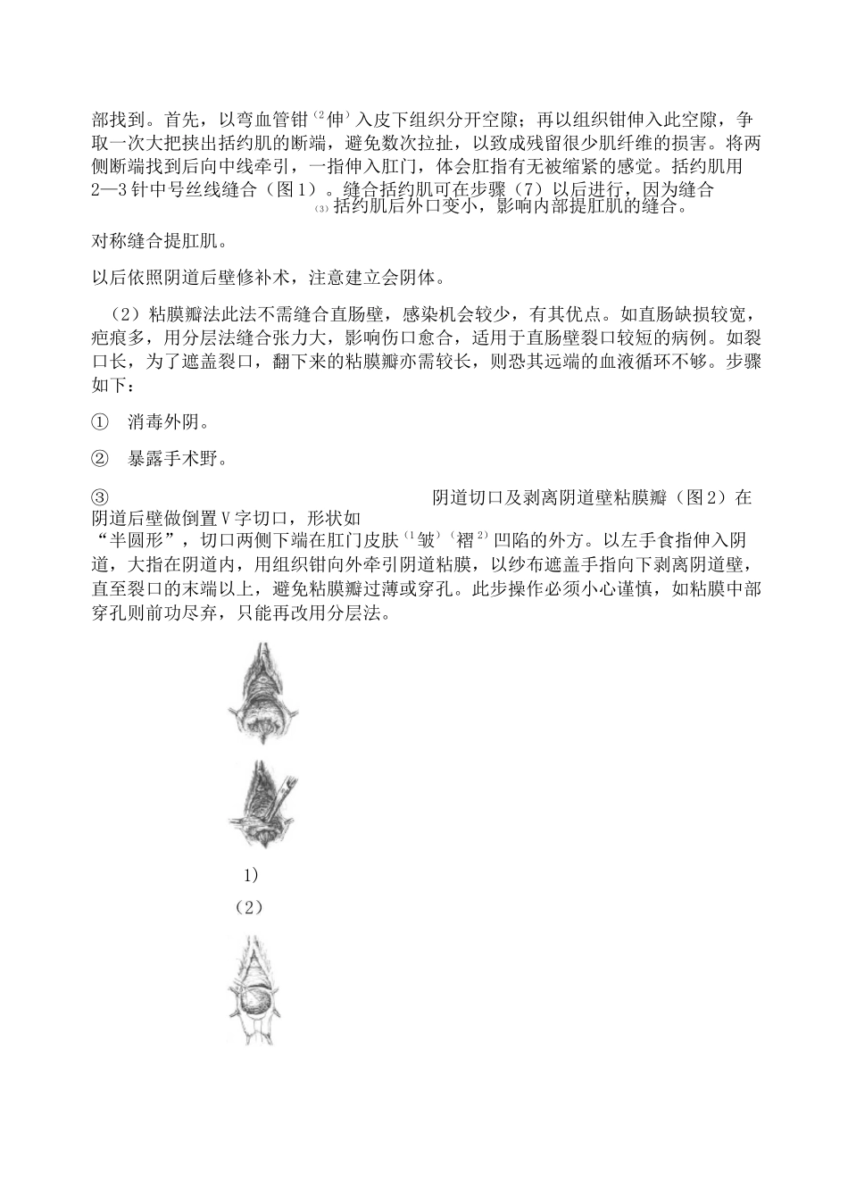 会阴Ⅲ度裂伤_第3页