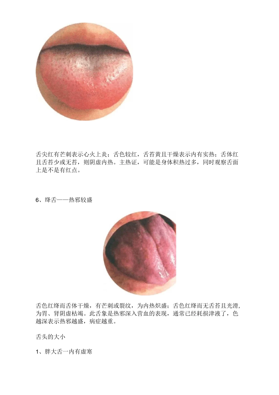 舌诊常见的舌苔舌形附高清图片典型舌象辩证_第3页