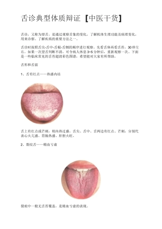 舌诊常见的舌苔舌形附高清图片典型舌象辩证