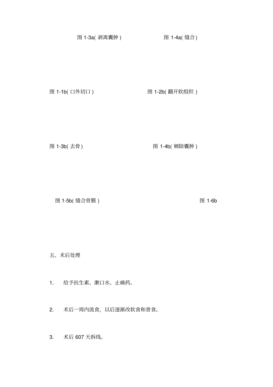 颌骨囊肿摘除术_第3页