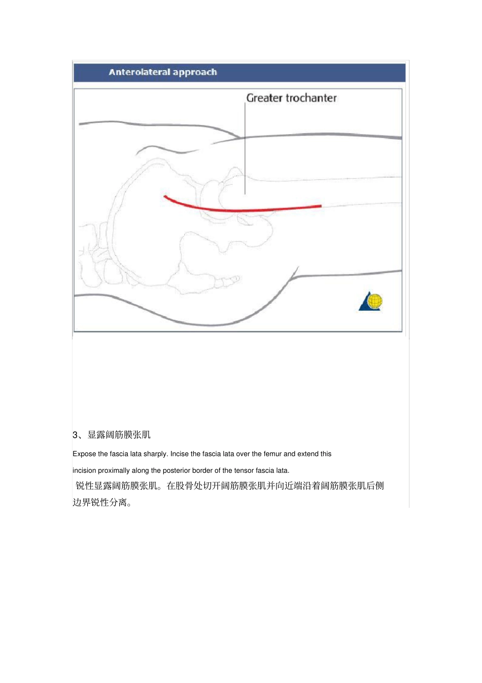 髋关节前外侧入路----Watson-Jones切口_第2页