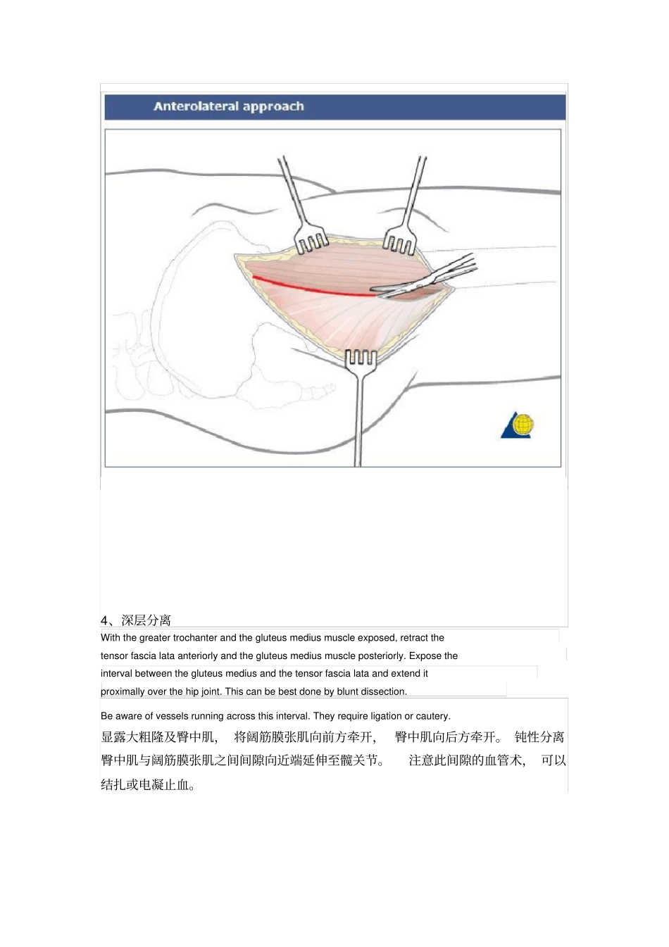 髋关节前外侧入路----Watson-Jones切口_第3页