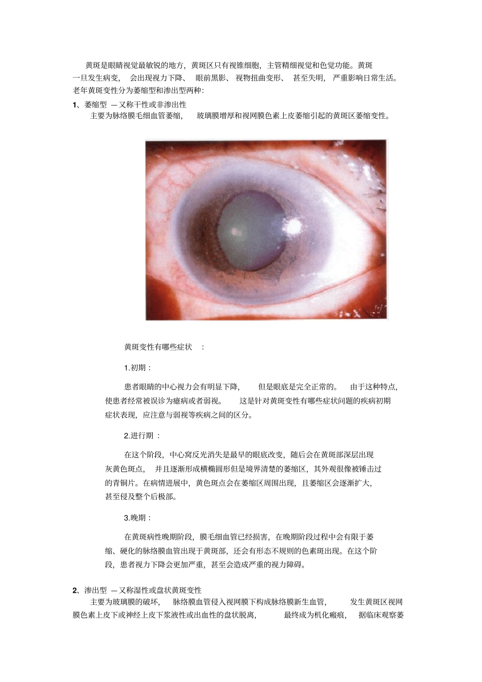 黄斑变性的症状及治疗方案_第1页