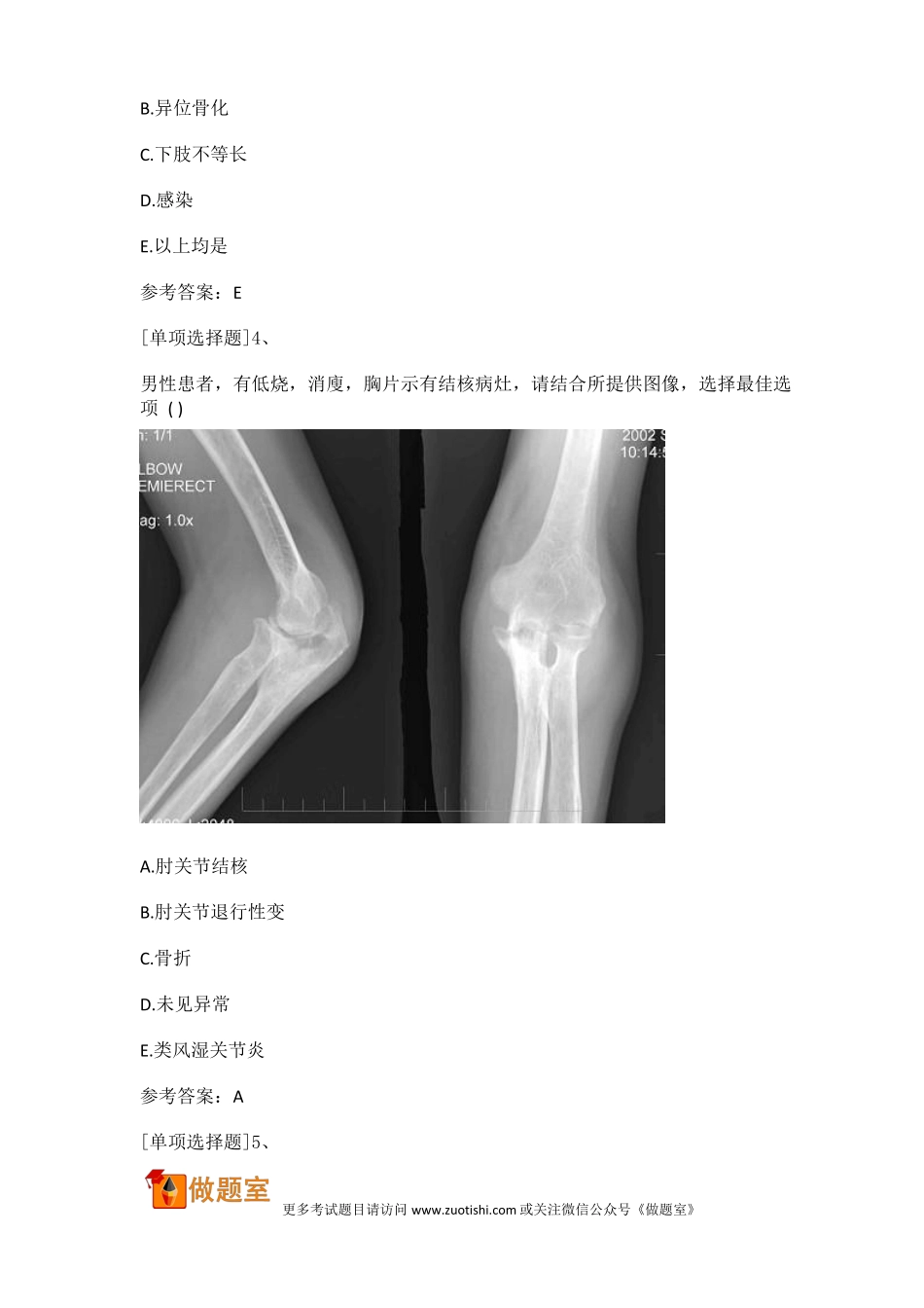 2018年骨外科学副主任医师真题精选副高_第2页