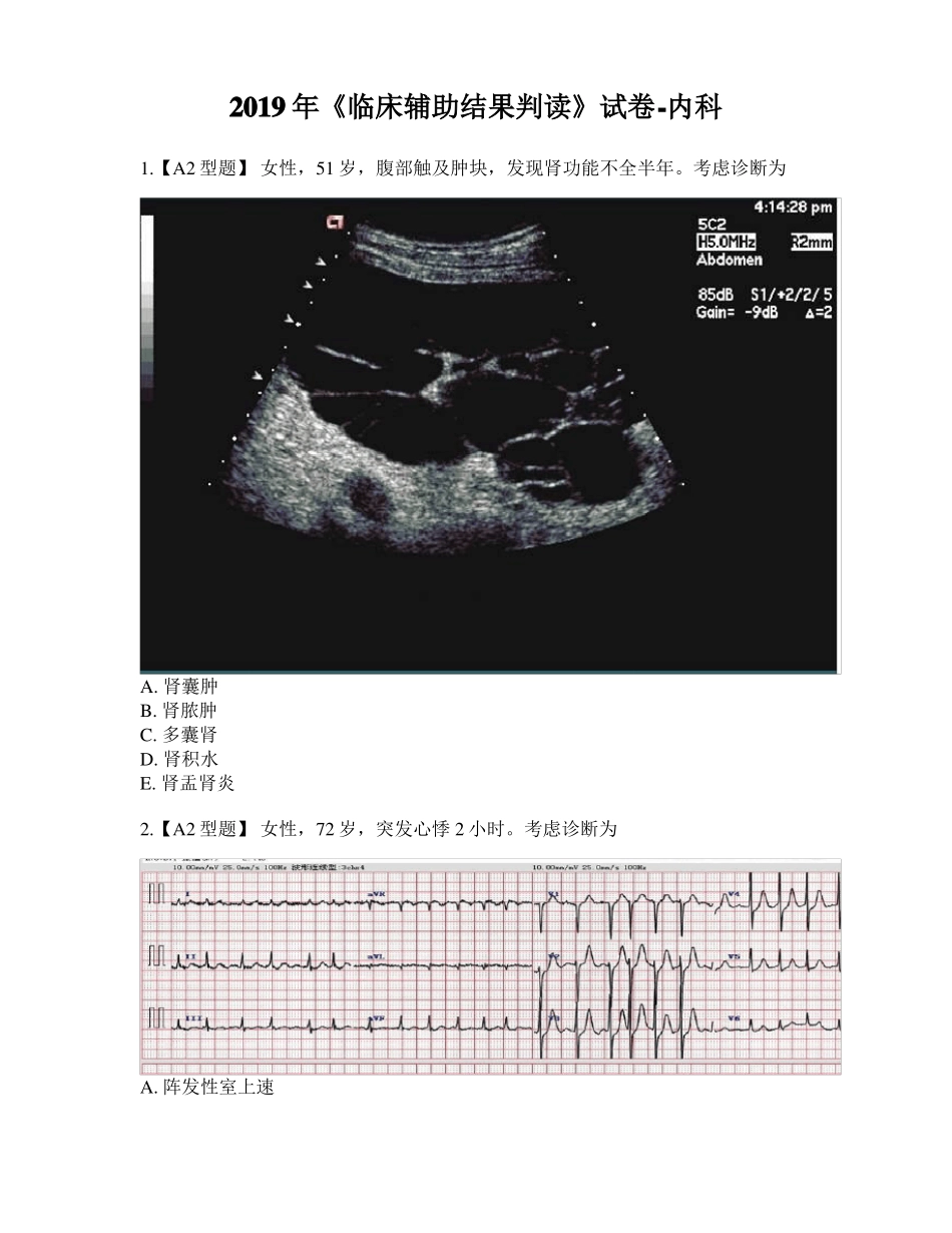 2019年临床辅助结果判读试卷-内科_第1页
