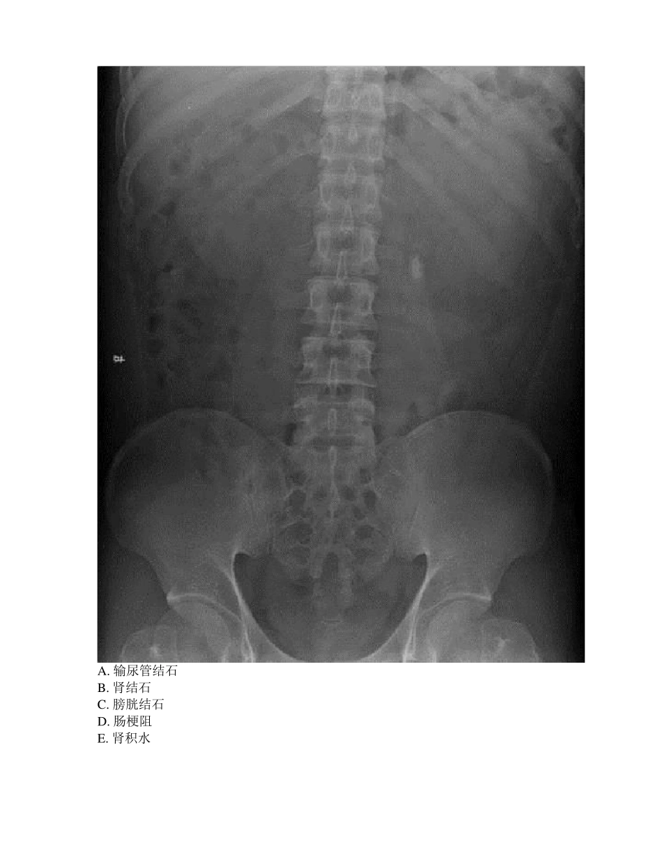 2019年临床辅助结果判读试卷-内科_第3页